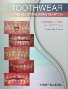 ĥ֢ӢİToothwear- The ABC of the Worn Dentition